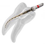 Ace endodontice rotative Navigator EVO - Basic set, 31 mm